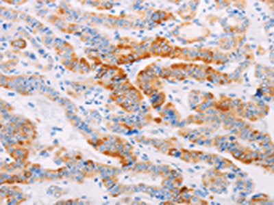 MAP4K3 Antibody