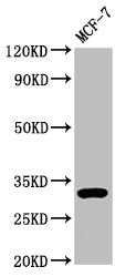 DKK2 Antibody
