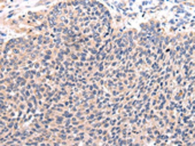 CCL7 Antibody