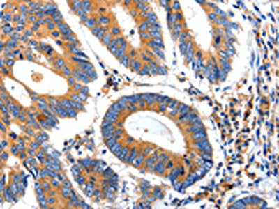 IGFBP7 Antibody