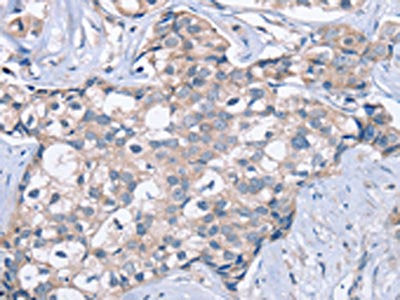 KCNQ5 Antibody