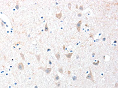 ADAM20 Antibody