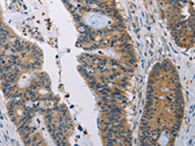 AMBP Antibody