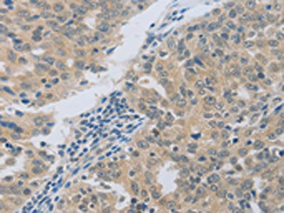 MAGEB4 Antibody