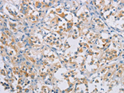 CERKL Antibody