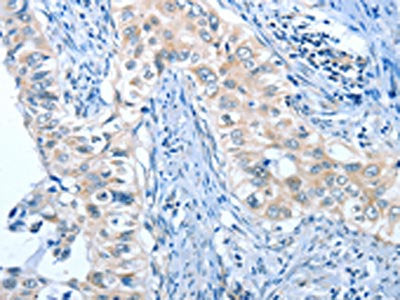 ANGPT2 Antibody