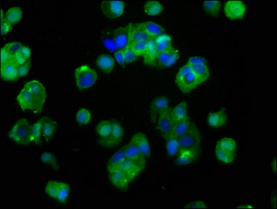 IGF1R Antibody