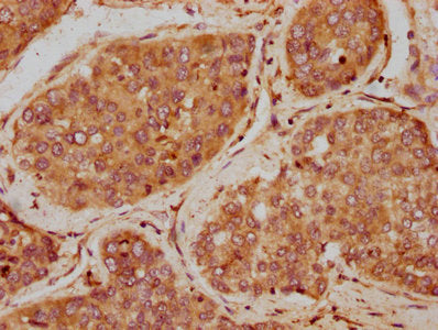 IGF1 Antibody