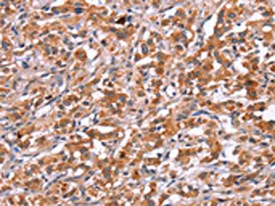 ICAM5 Antibody