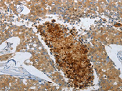 NGFR Antibody