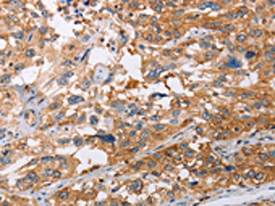 NLRP3 Antibody