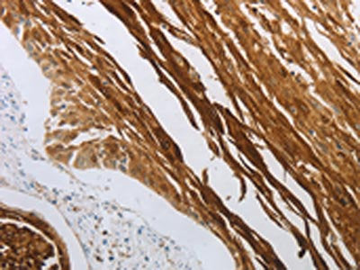NOTCH1 Antibody