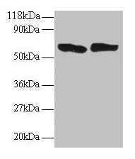 TNF Antibody