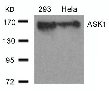 MAP3K5 (Ab-966) Antibody
