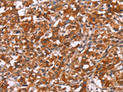 HSPB6 Antibody