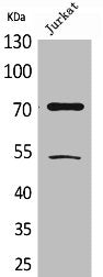 Acetyl-XRCC6 (K539) Antibody