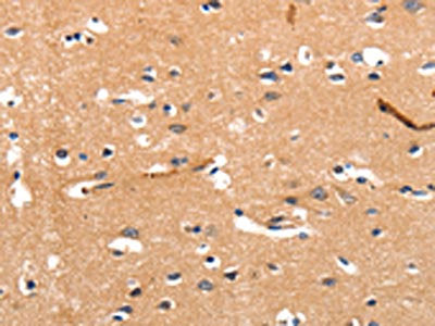 CHRNA3 Antibody