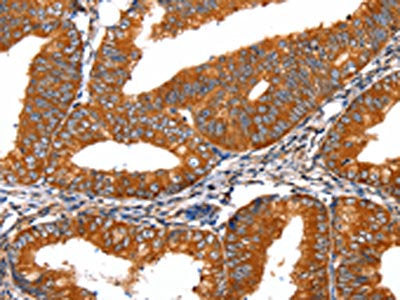 FGFR1 Antibody