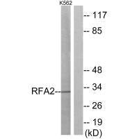 RPA2 (Ab-21) Antibody