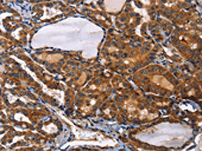 ILK Antibody