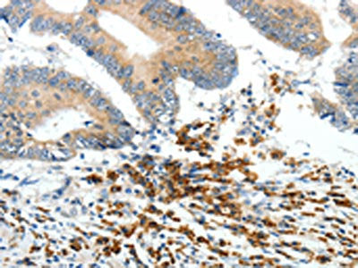 PTEN Antibody
