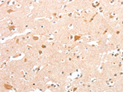 CIDEC Antibody