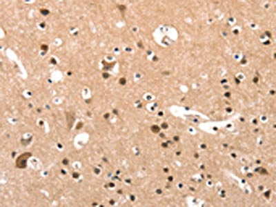 ELOVL6 Antibody