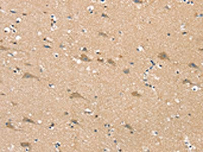SGPL1 Antibody