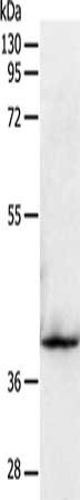 SIRT2 Antibody