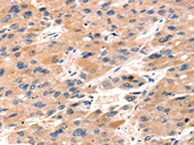TAP2 Antibody