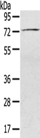 SLC27A5 Antibody