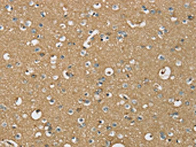 ATP2A3 Antibody