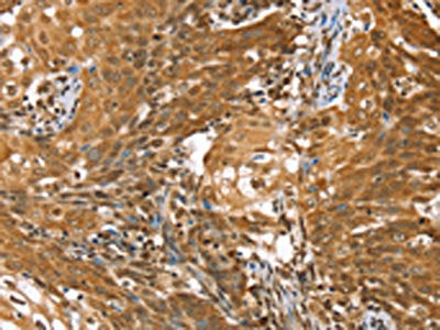 STK32B Antibody