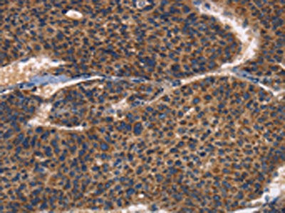 ITGB3 Antibody