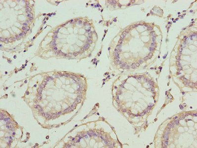 PLA2G7 Antibody