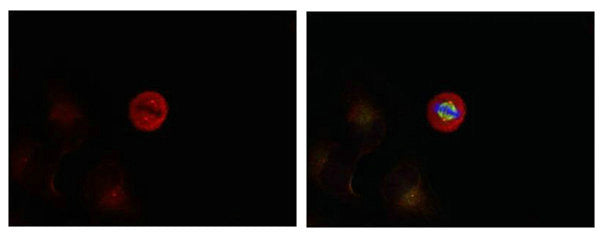 Phospho-MAPK3 (Tyr204) Antibody