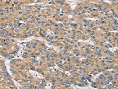 RBM38 Antibody
