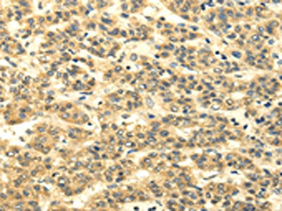MSI1 Antibody