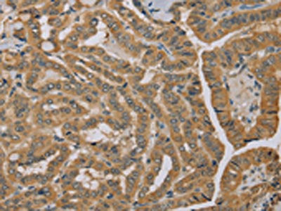 MVK Antibody