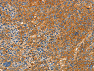 APPL1 Antibody