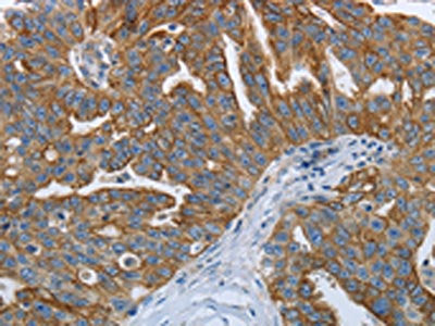 RETN Antibody