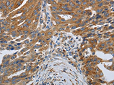 SPAG1 Antibody