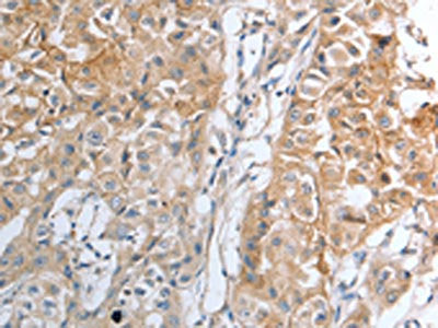 HAVCR1 Antibody