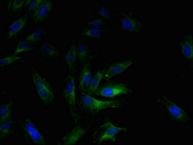 Ccl2 Antibody