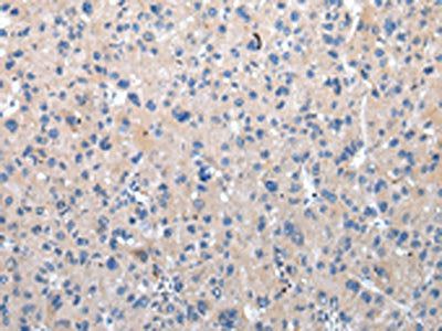 ZFAND2A Antibody