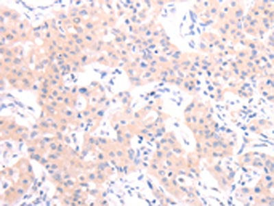 HCRT Antibody