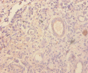 Ccl4 Antibody