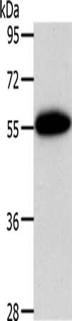 AGT Antibody