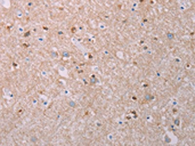 AKT2 Antibody