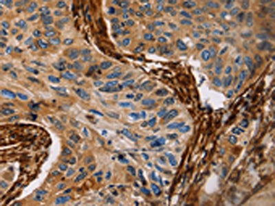 CALD1 Antibody